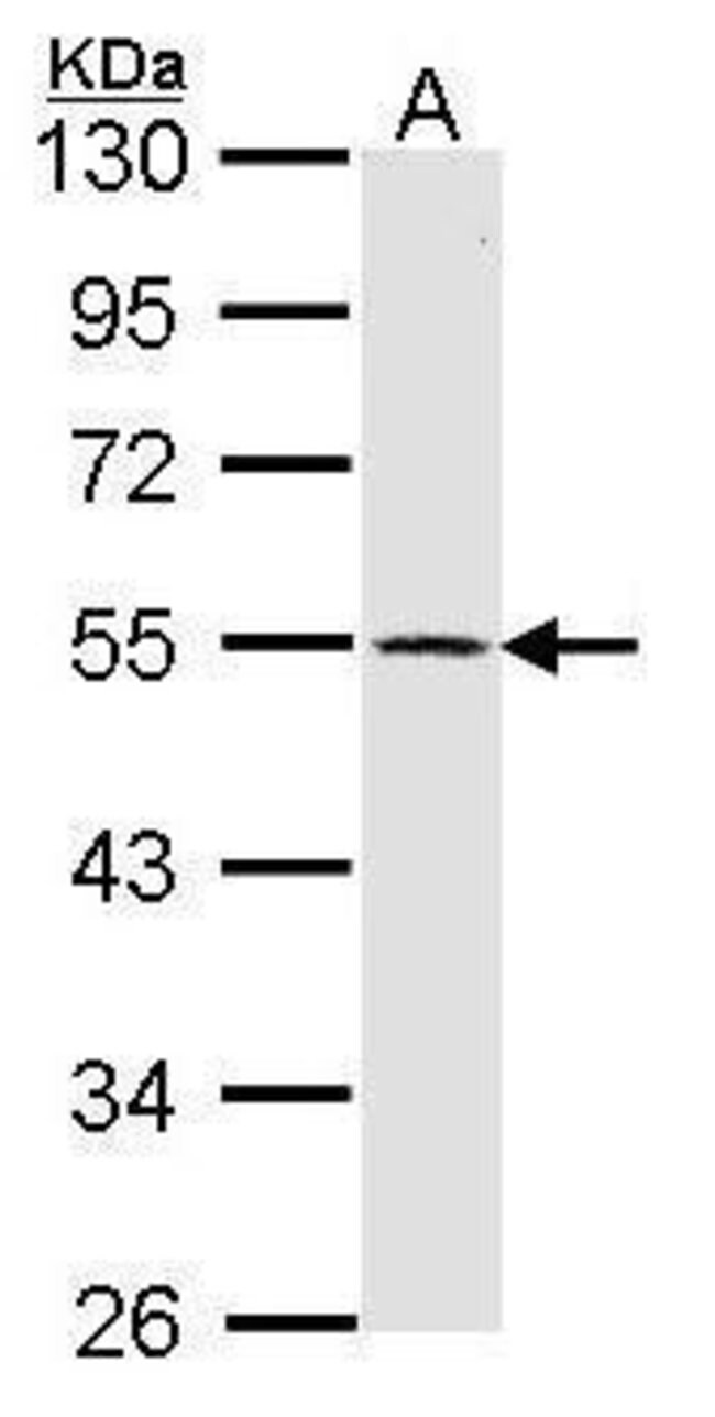 ANTI-DOPAMINE RECEPTOR D1