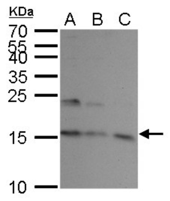 ANTI-UBE2A