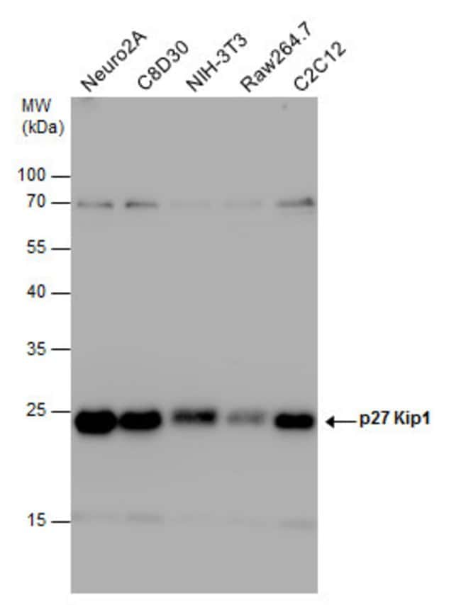 ANTI-P27 KIP1