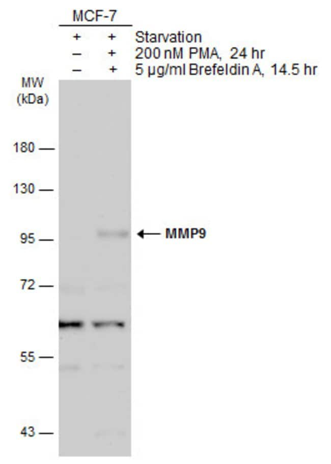 ANTI-MMP9