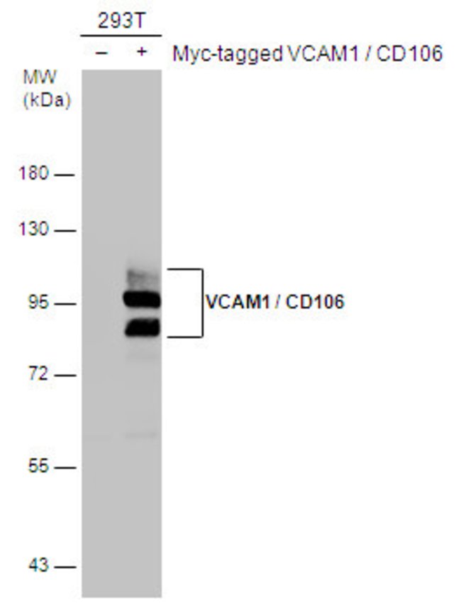 ANTI-VCAM1