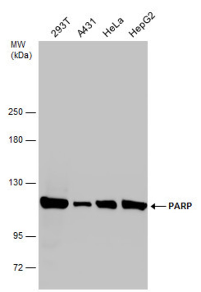 ANTI-PARP1