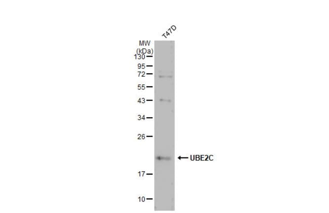 ANTI-UBE2C