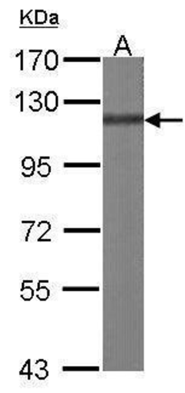 ANTI-BCAR1