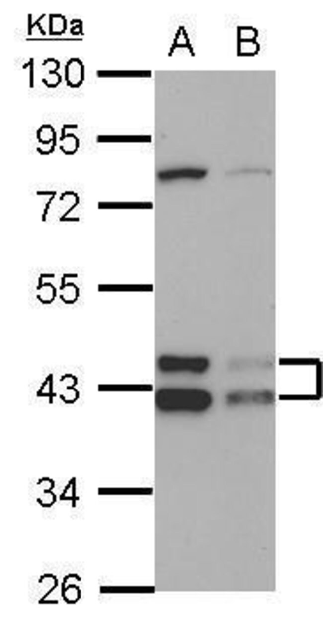 ANTI-TID1