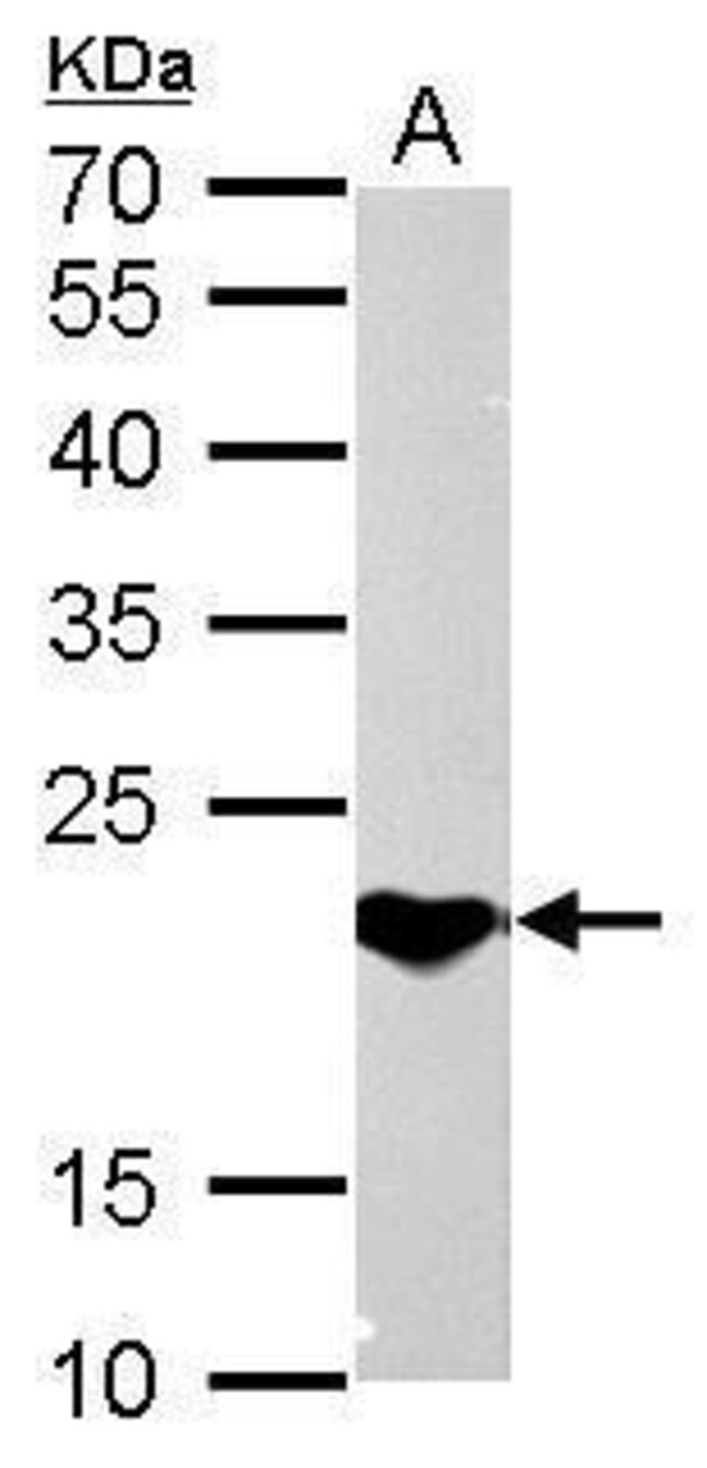 ANTI-SOCS1