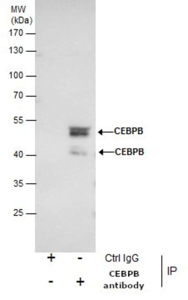 ANTI-C/EBP BETA