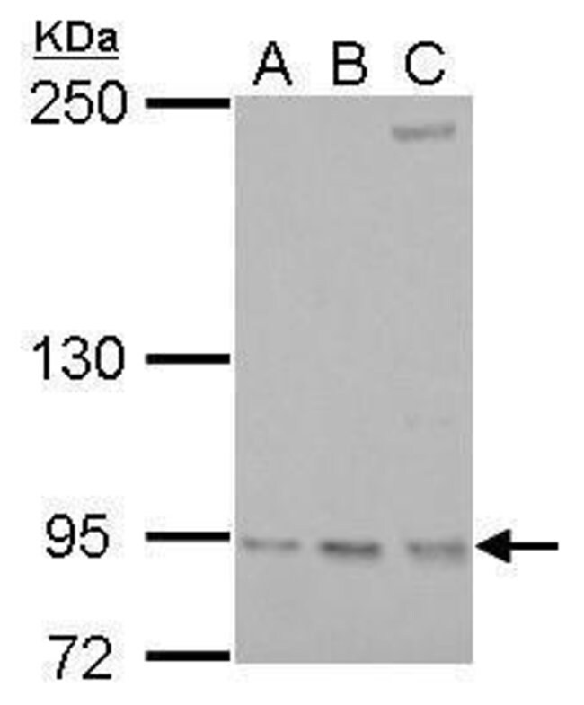 ANTI-RRM1