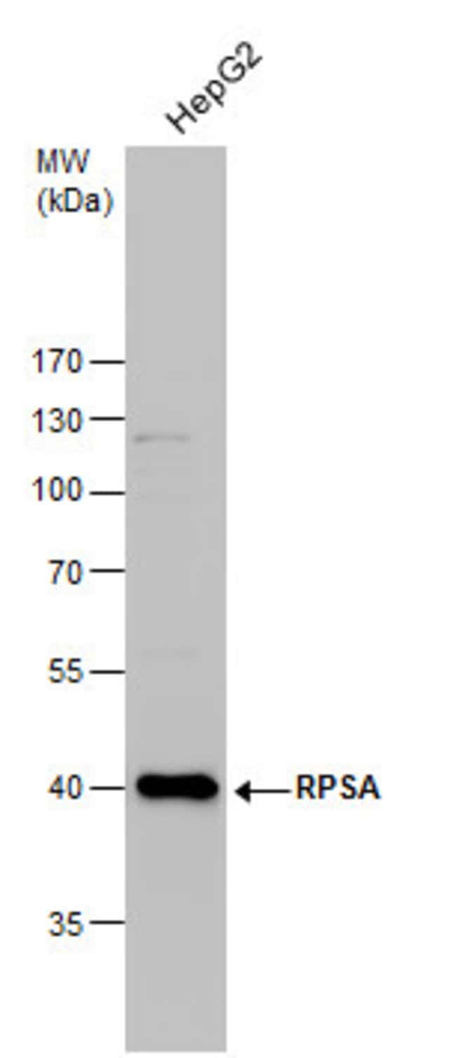 ANTI-RPSA