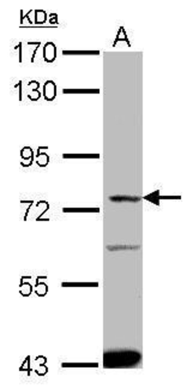 Anti-ACSVL4