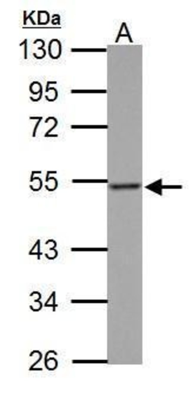 ANTI-PD-ECGF