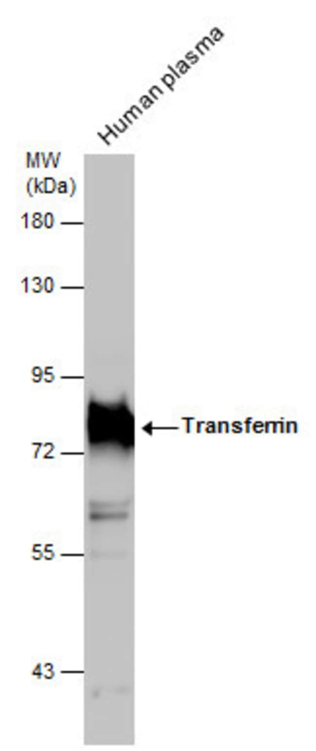 ANTI-TRANSFERRIN