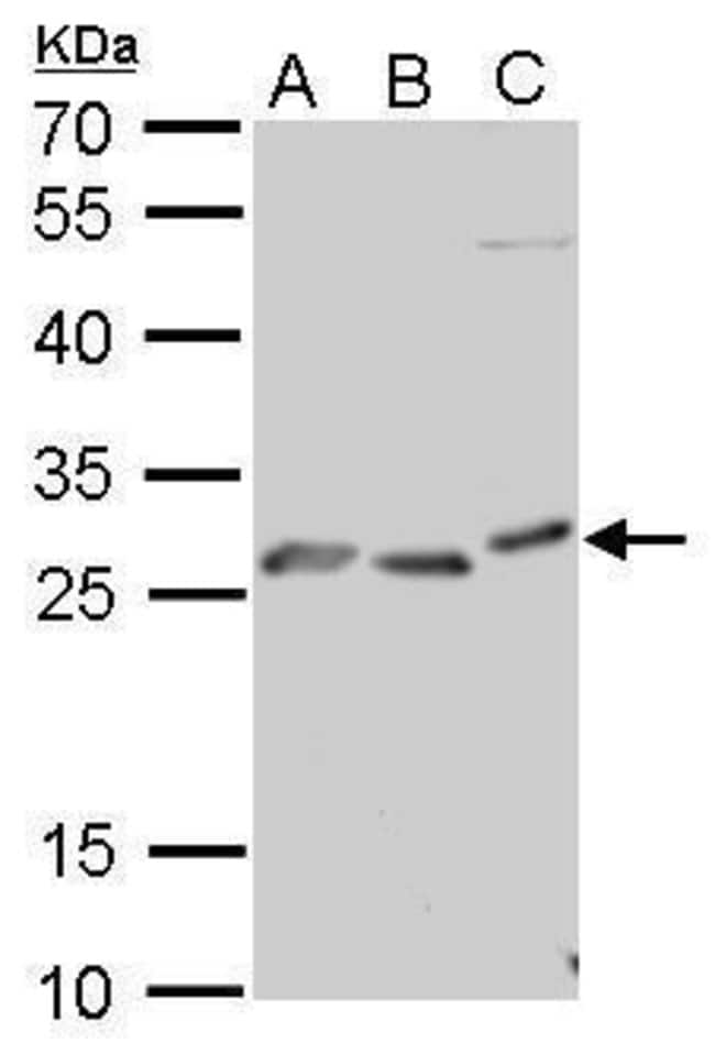 ANTI-PRP