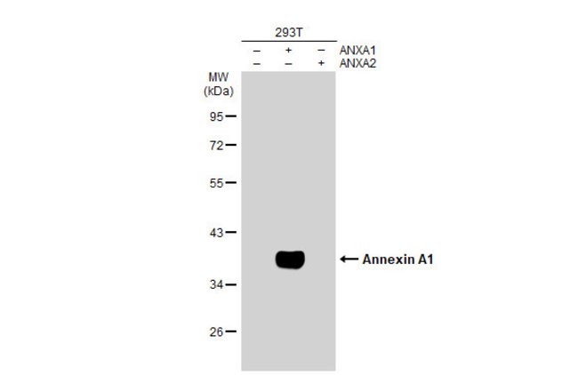 ANTI-ANNEXIN A1