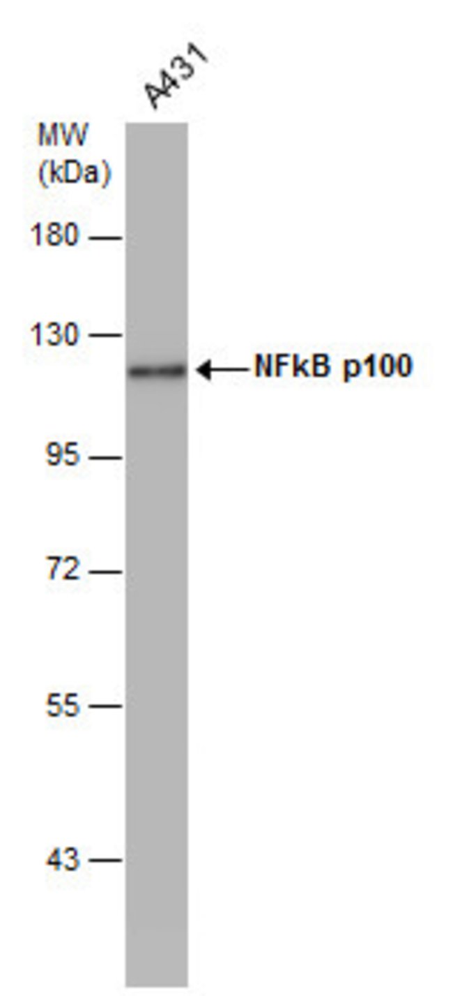 ANTI-NFKB P100/P52