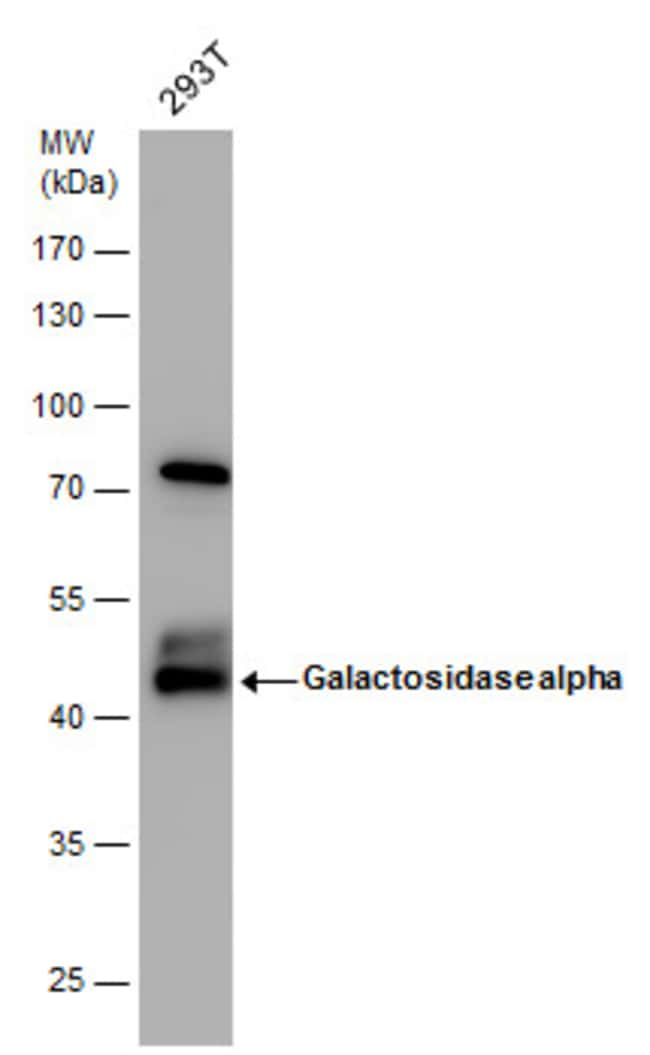 ANTI-GALACTOSIDASE ALPHA