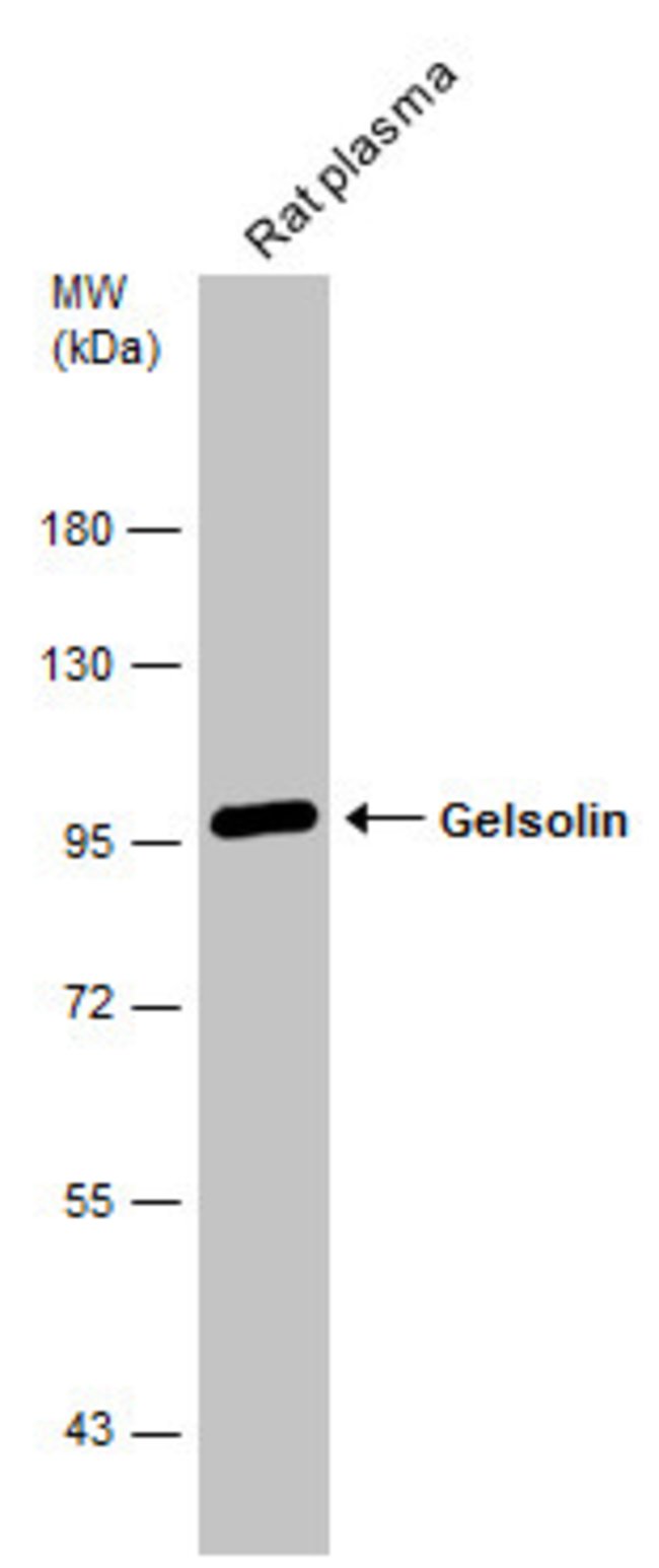 ANTI-GELSOLIN