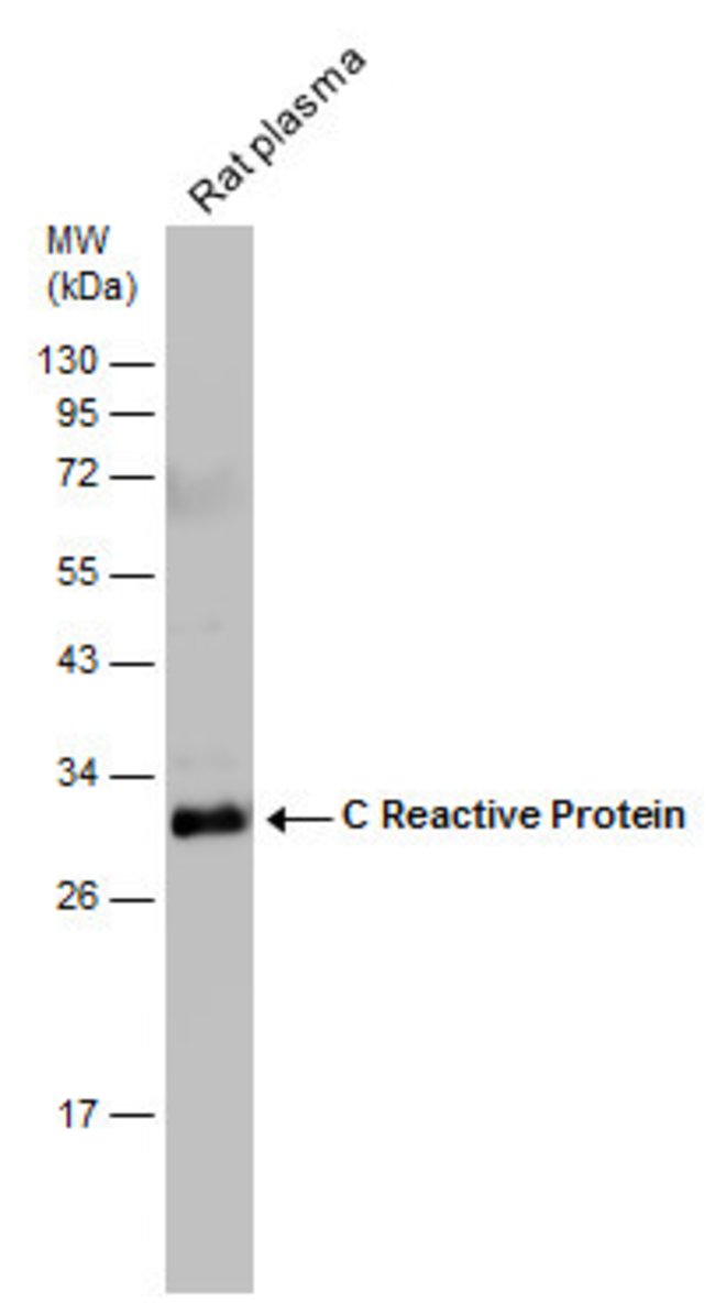 ANTI-C REACTIVE PROTEIN