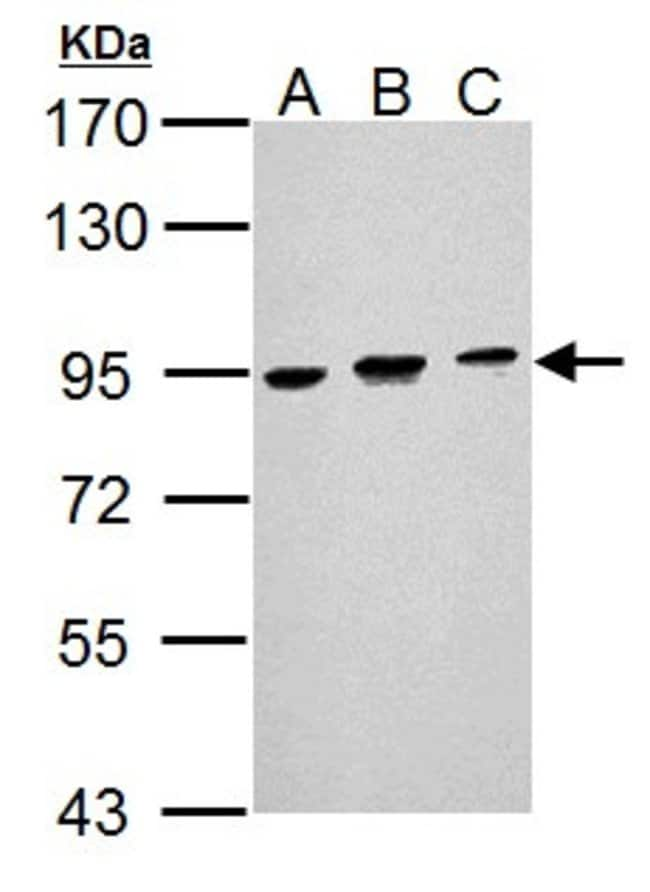 ANTI-BCL6