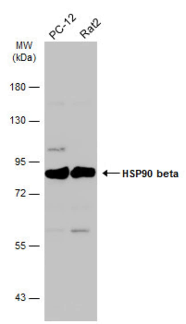 ANTI-HSP90 BETA