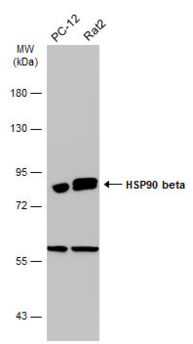 ANTI-HSP90 BETA