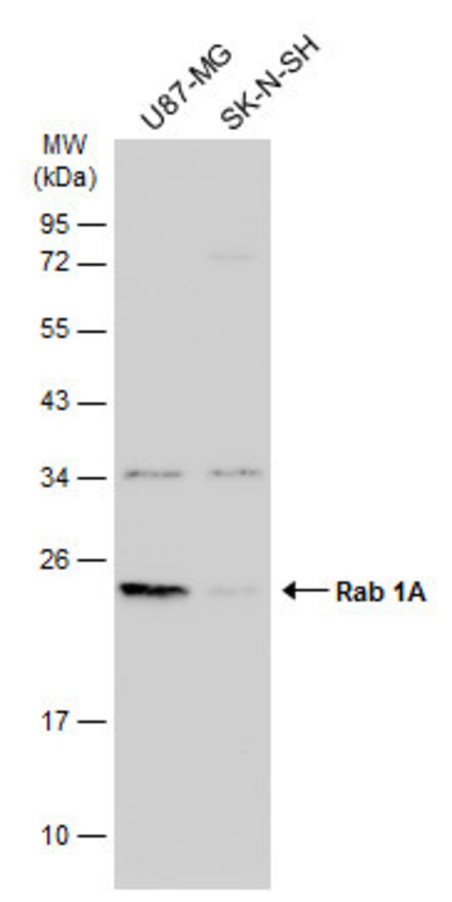 ANTI-RAB 1A