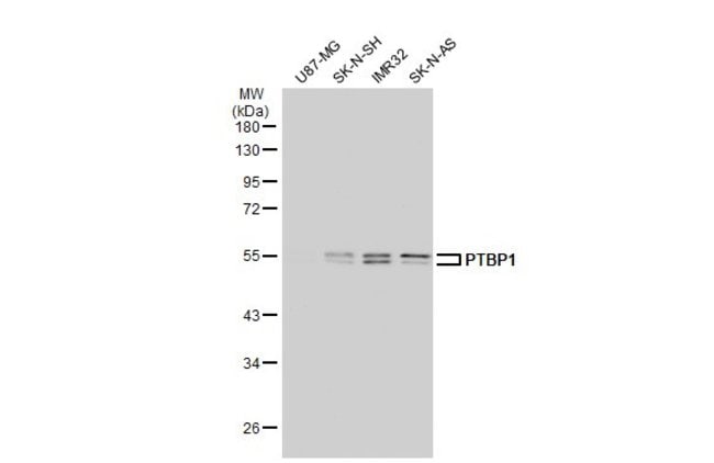 ANTI-HNRNP 1