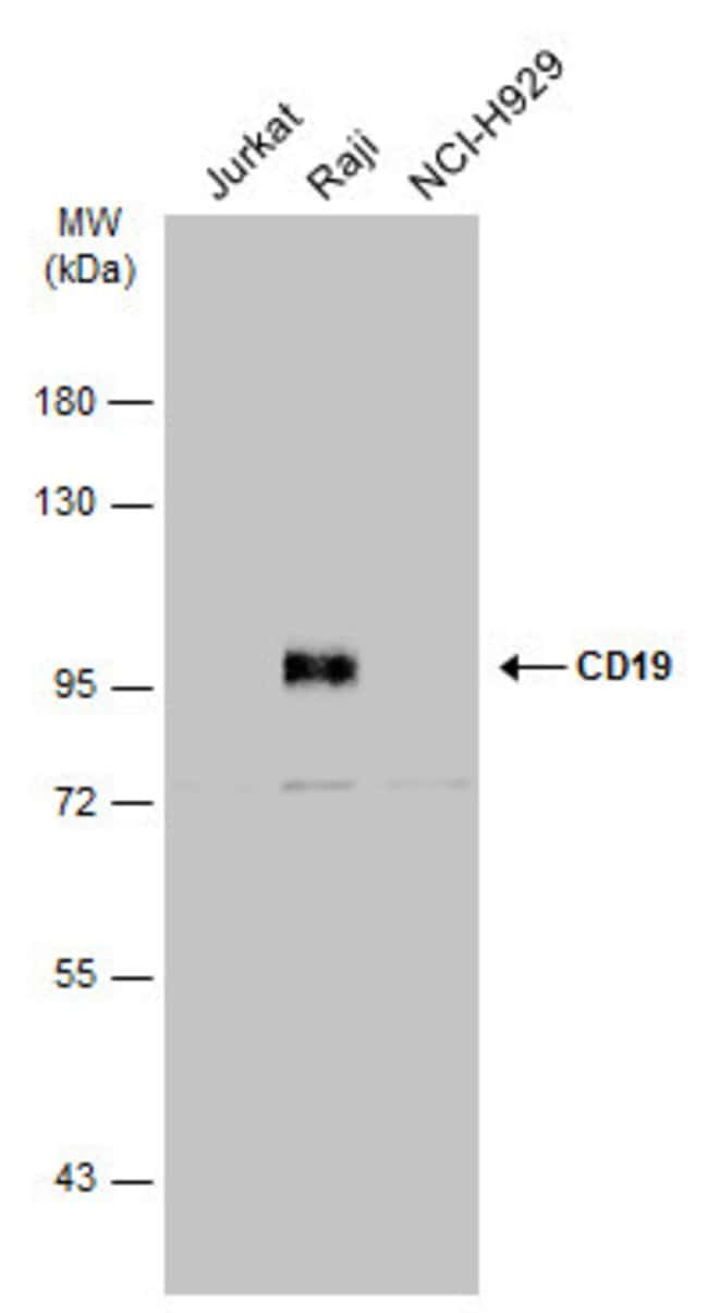 ANTI-CD19