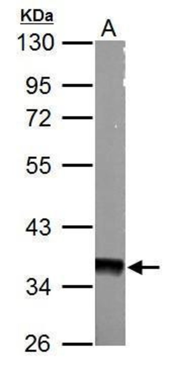 ANTI-AMPK GAMMA 1