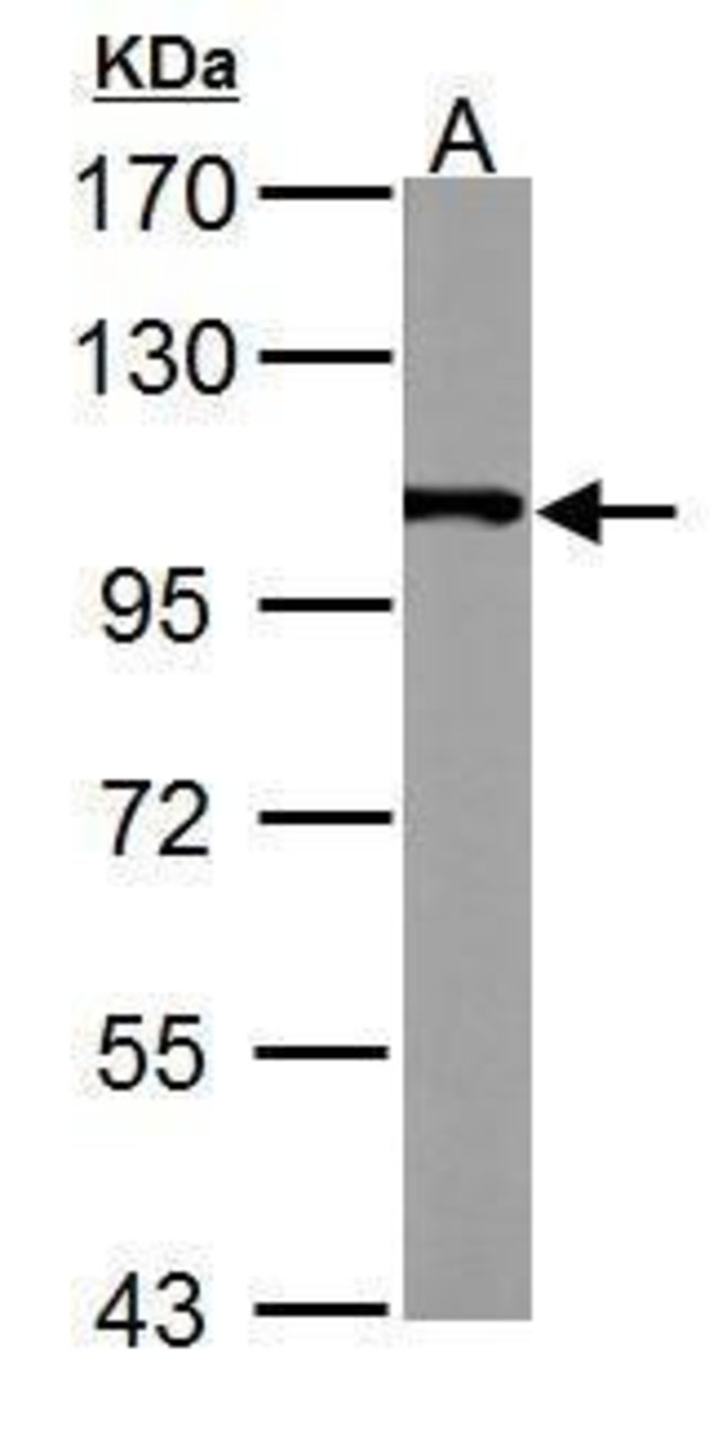 ANTI-ALPHA ACTININ 4