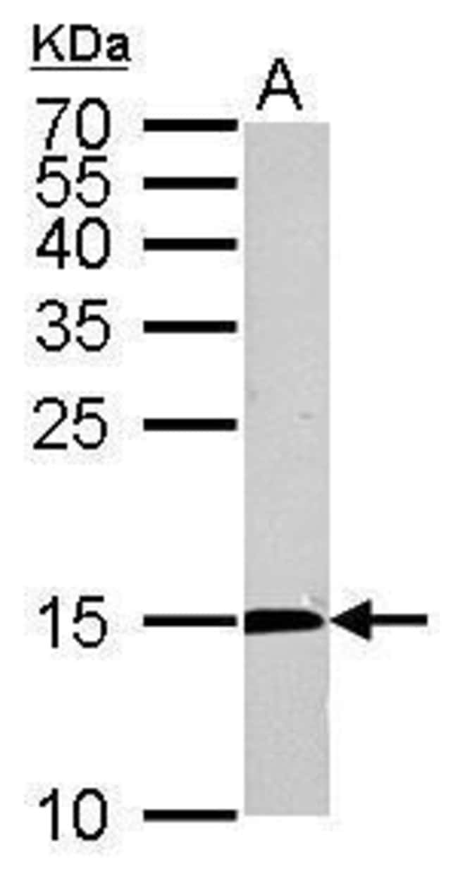 ANTI-CYTIDINE DEAMINASE