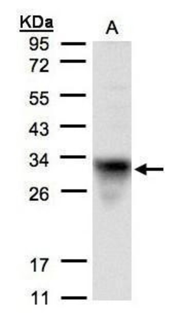 ANTI-CYTOCHROME C1