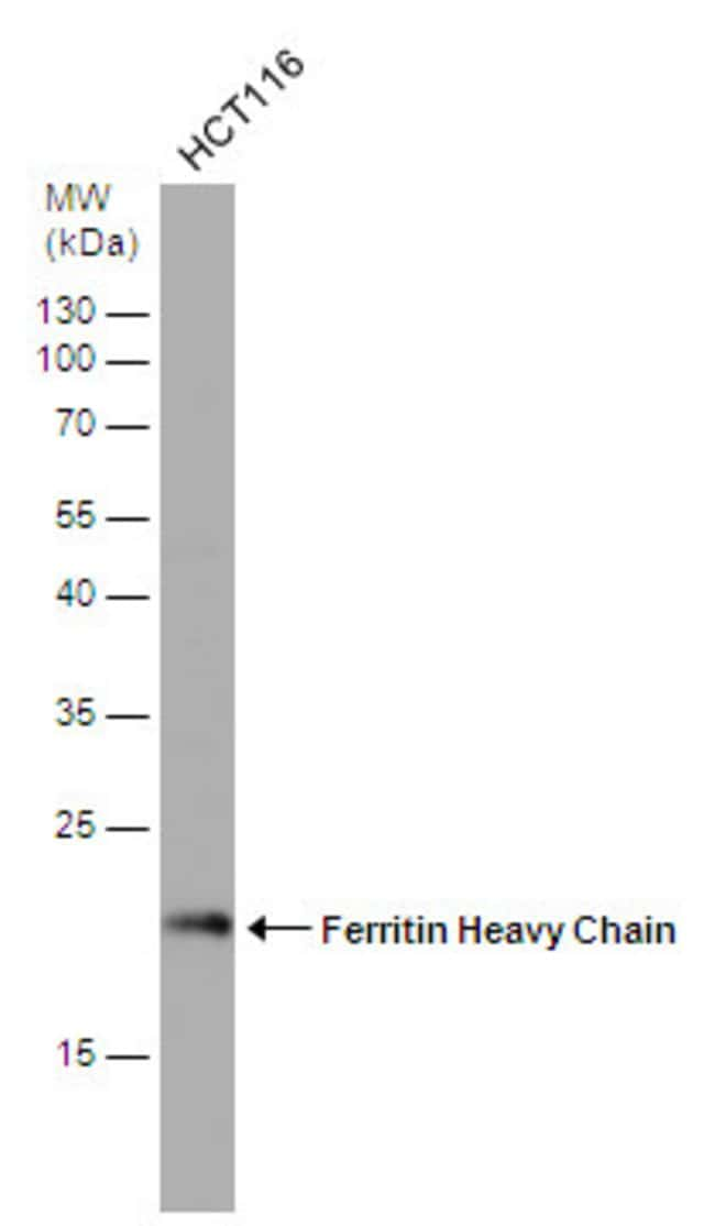 ANTI-FERRITIN HEAVY CHAIN