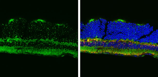 ANTI-ATP5A1