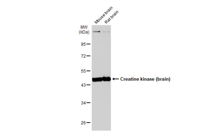 ANTI-CREATINE KINASE (BRAIN)