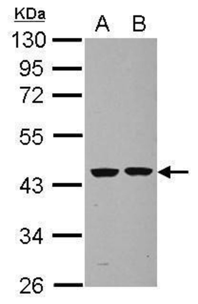 ANTI-SEPTIN 2