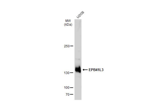 ANTI-EPB41L3