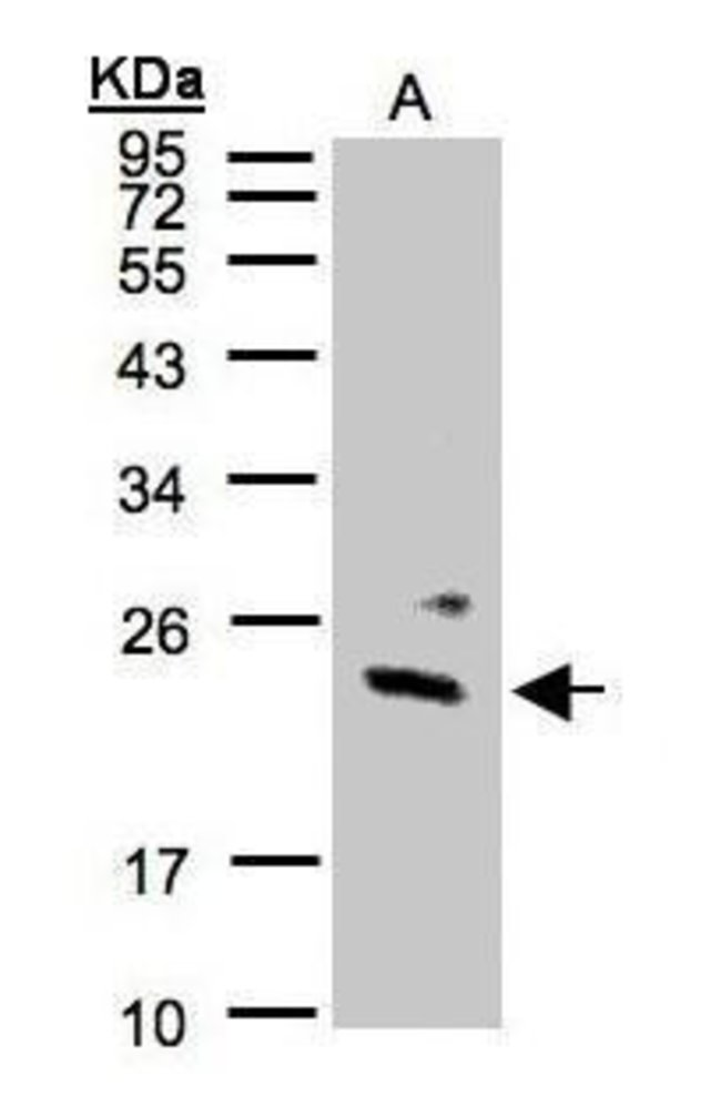 ANTI-GUANYLATE KINASE