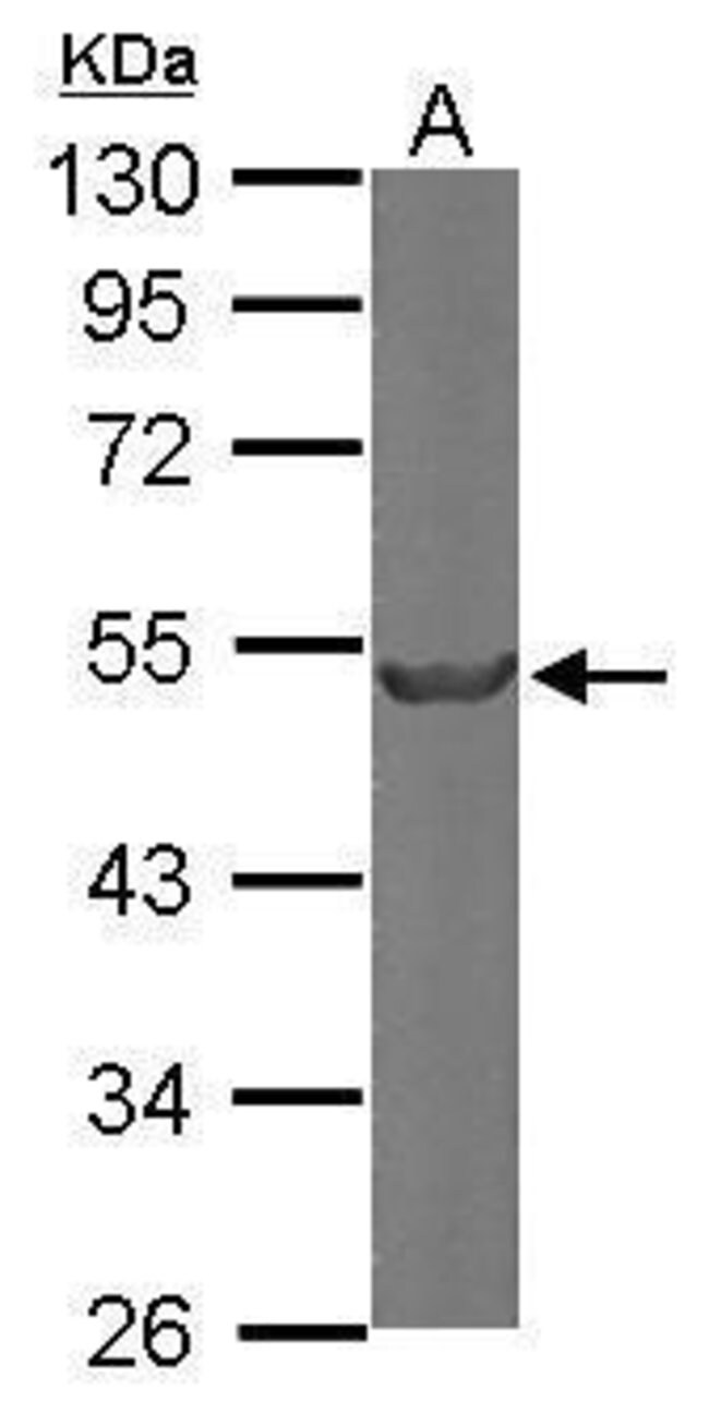 ANTI-BETA TUBULIN 2