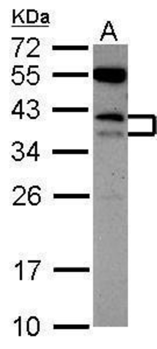 ANTI-CD79B