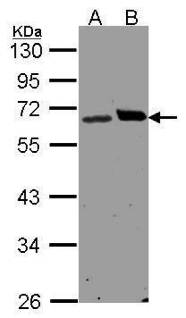 ANTI-RIBOPHORIN I