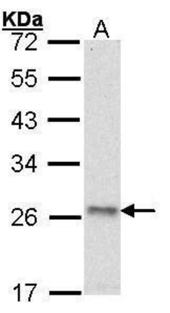 ANTI-ATP SYNTHASE O