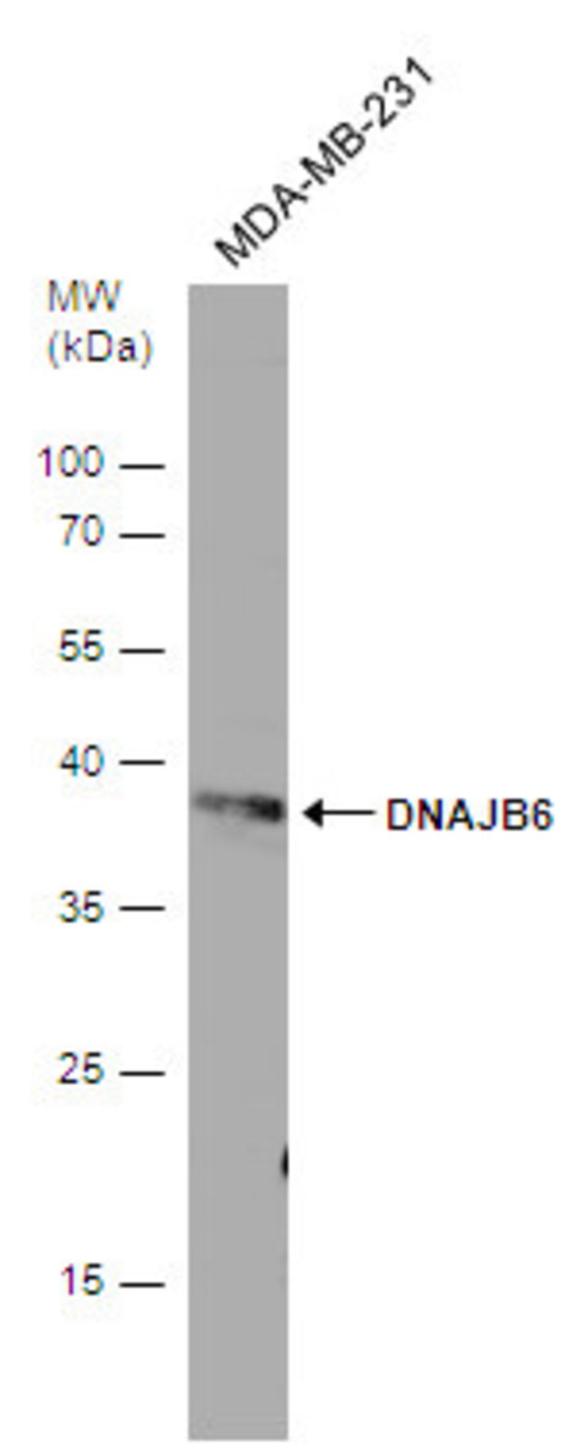 ANTI-DNAJB6