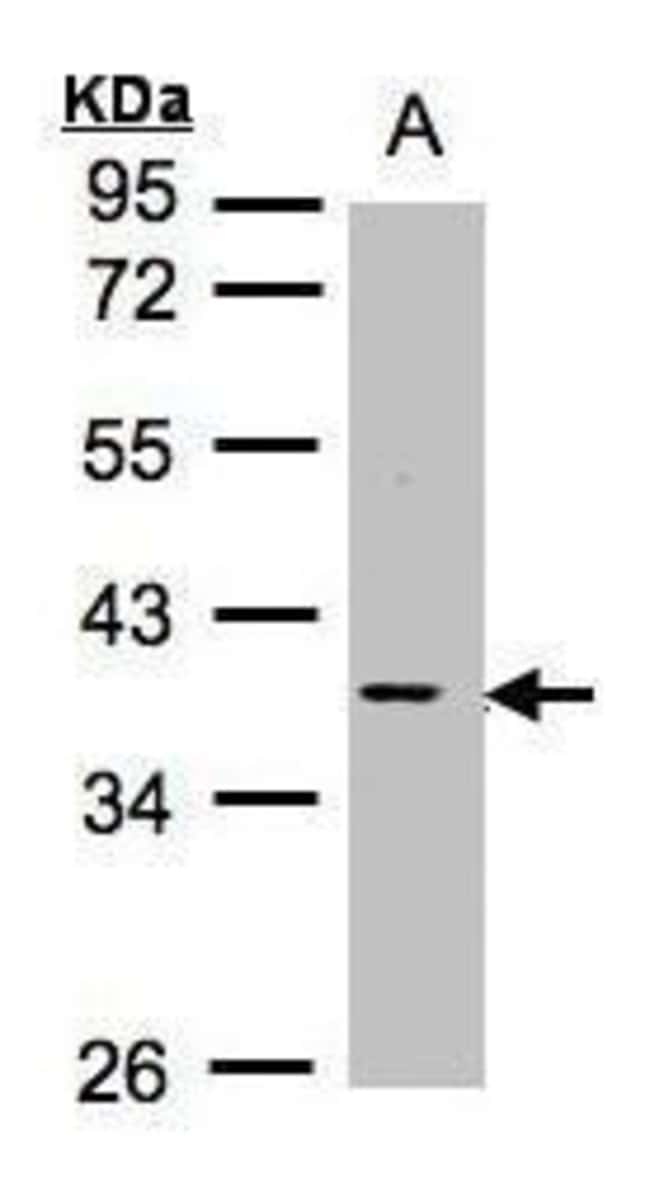 ANTI-MCL1