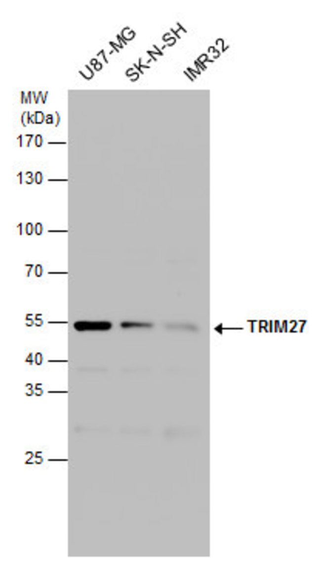 ANTI-TRIM27