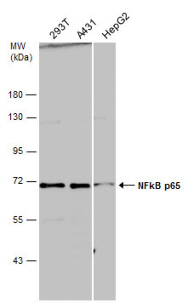 ANTI-NFKB P65