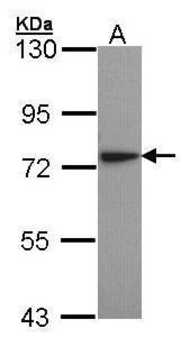 ANTI-LYSYL-TRNA SYNTHETASE