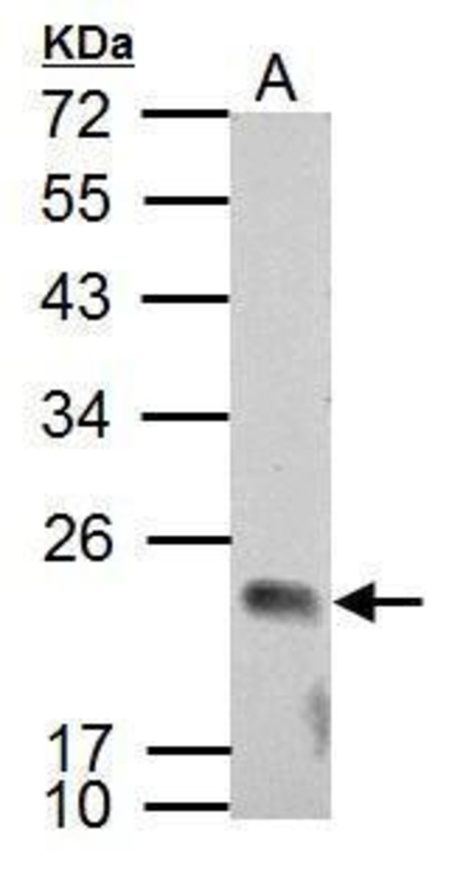 ANTI-APOBEC3C