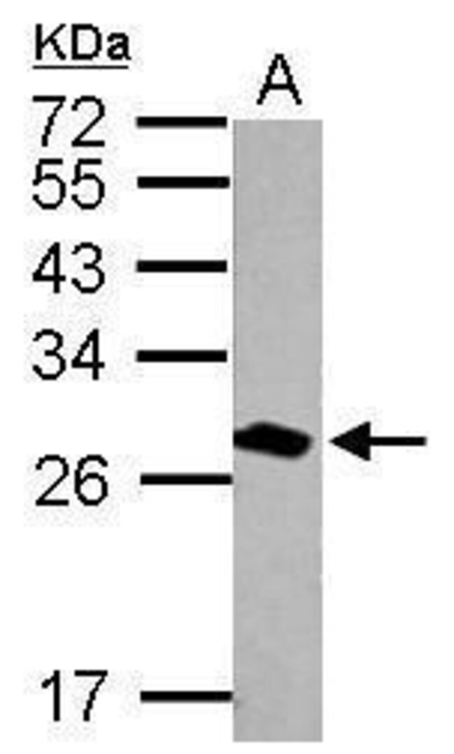 ANTI-14-3-3 THETA