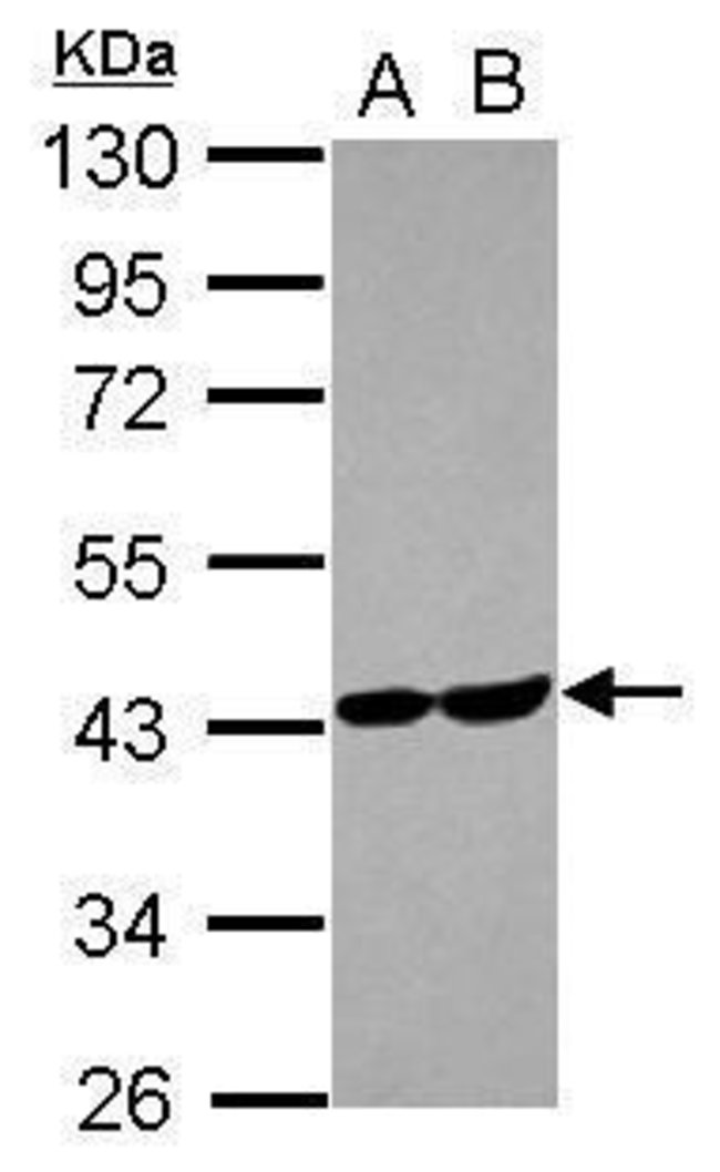 ANTI-ALDOLASE C